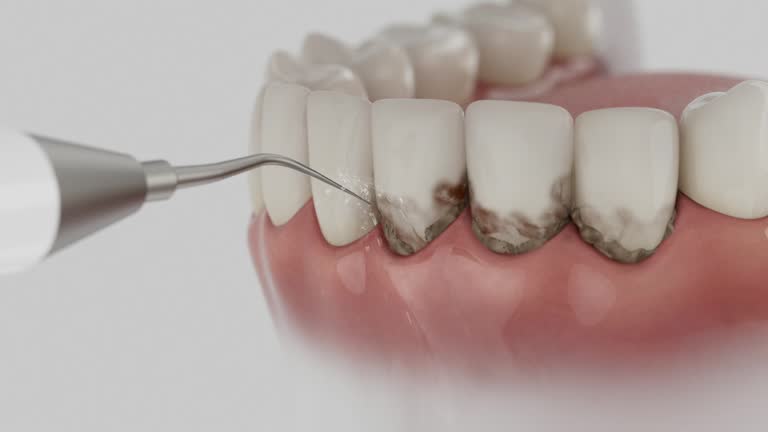 Reliable Dental Implants contractor in Biloxi, MS by Smile Center Dentistry